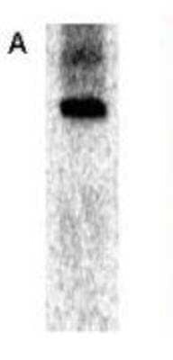 Western Blot: SARS-CoV NSP8 Antibody [NBP2-89180] - immunoprecipitation followed by western blotting using  Anti-nsp8 shows a predominant band at 21.8 kDa corresponding to full length SARS protein (panel A). Immunofluorescence Microscopy using anti-nsp8 6-h post infection of Vero-E6 cells (Panel B). For detection Cy3 conjugated Goat-anti-Rabbit IgG was used.